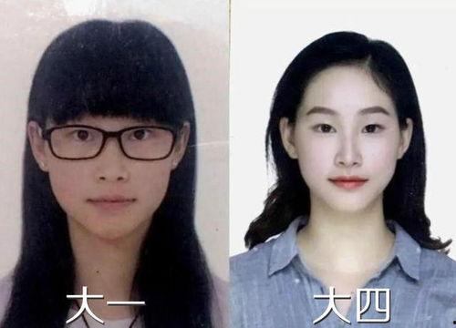 男孩整容27次爆料视频,揭秘男孩整容之路的辛酸历程